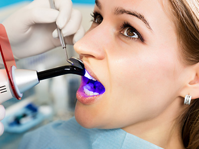 A woman wearing a surgical mask is using a dental tool to examine a person s teeth, with her mouth open wide to show the blue light from the device.