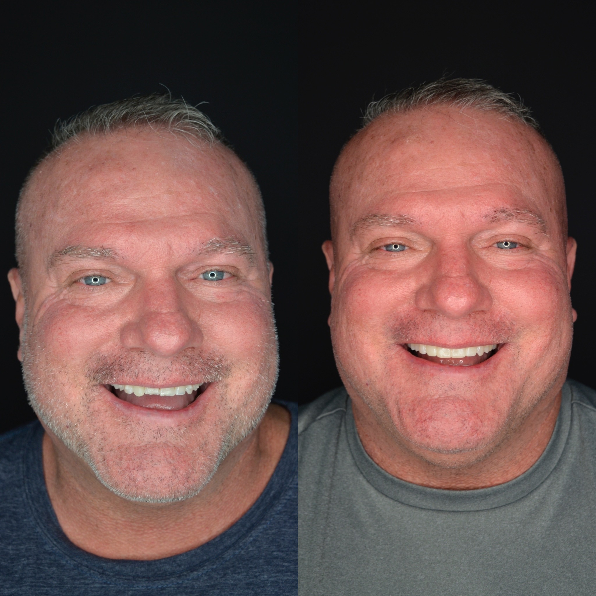 The image displays three identical photographs of a man with a beard and mustache, smiling broadly, against different backgrounds.