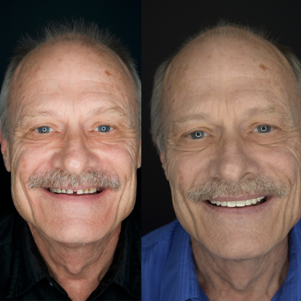 The image shows three different facial expressions of an older man with gray hair, wearing blue jeans and a white shirt in each panel.