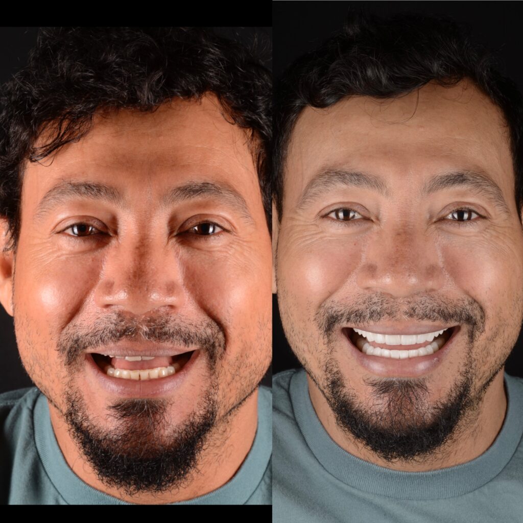 The image shows a man s face with three different expressions against a black background.