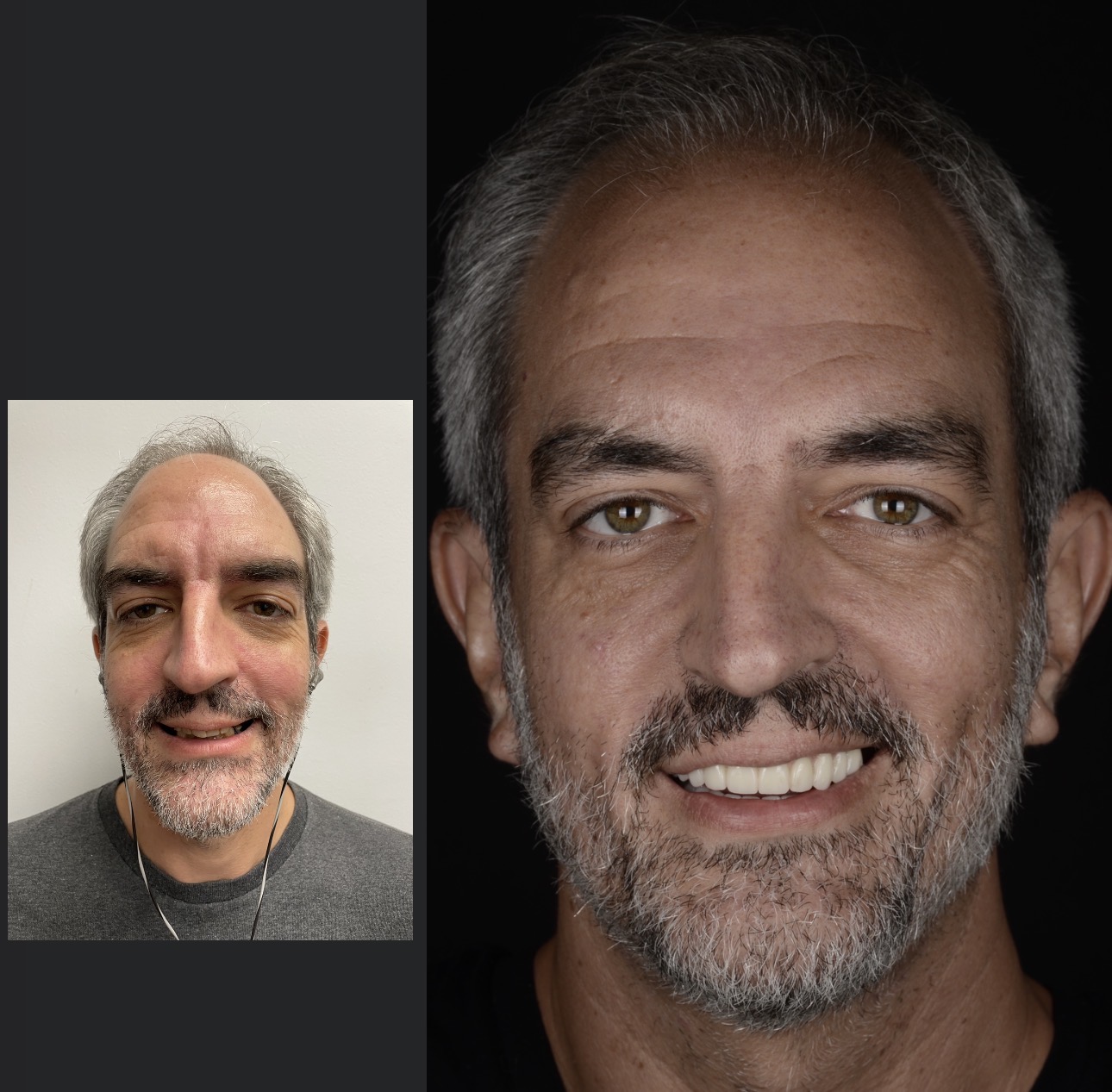The image shows three different views of a man with facial hair, presented side by side against a black background.