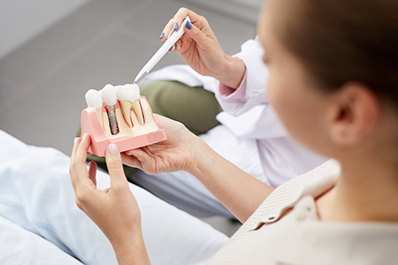 A person holding a model mouth with teeth being fitted by a dental professional, likely in a dental office setting.