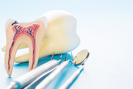 The image shows two different views of a tooth with an implant, placed next to a dental drill and other dental tools on a table, suggesting a dental care setting.